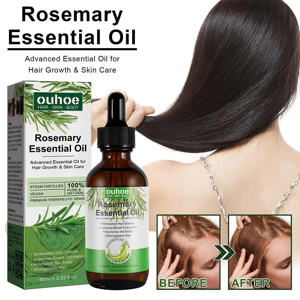 Rosemary Essential Oil with Dropper, 1/3PCS Rosemary Oil for Hair Growth, Hair Strengthening, Nourishing & Volumizing Refreshing